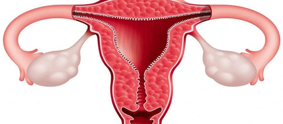 دکتر سرطان دهانه رحم