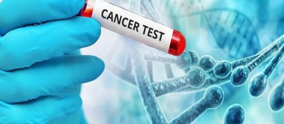 دکتر غربالگری سرطان